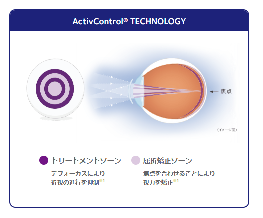 MiSight 1 dayの機序
