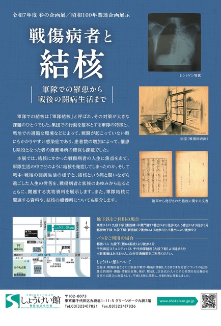 春季企划展「战伤病者与结核——从军队中的罹患到战后的抗病生活」